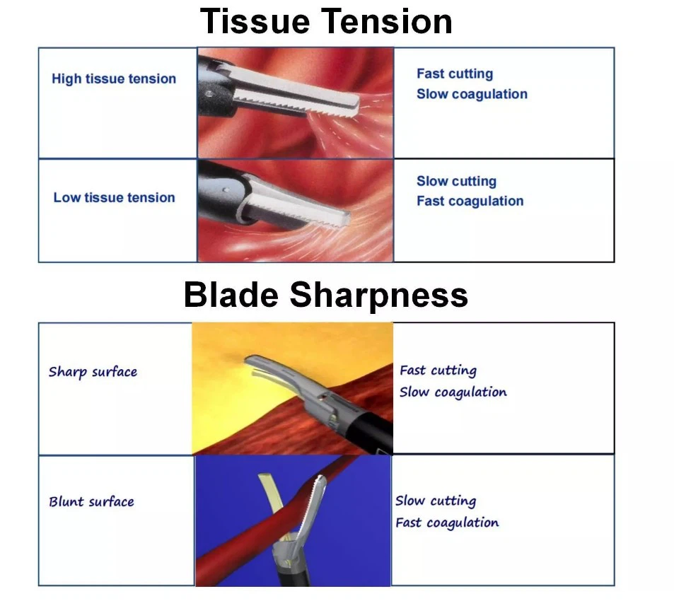 Ultrasonic Scalpel -2