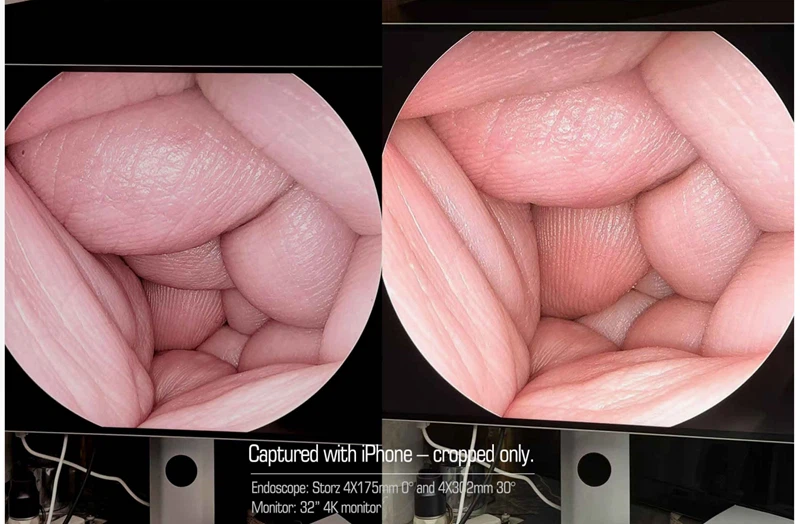 PORTABLE ENDOSCOPY CAMERA-7 PORTABLE ENDOSCOPY CAMERA-7
